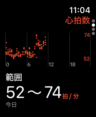 心電図モニター
